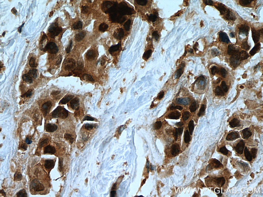 USP28 Polyclonal antibody