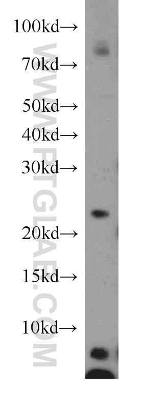ARFRP1 Polyclonal antibody