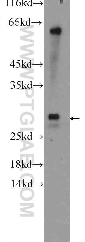 UBE2J2 Polyclonal antibody