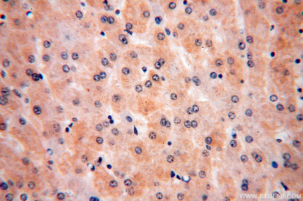 ULBP1 Polyclonal antibody