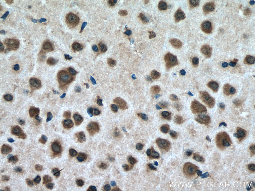 USMG5 Polyclonal antibody
