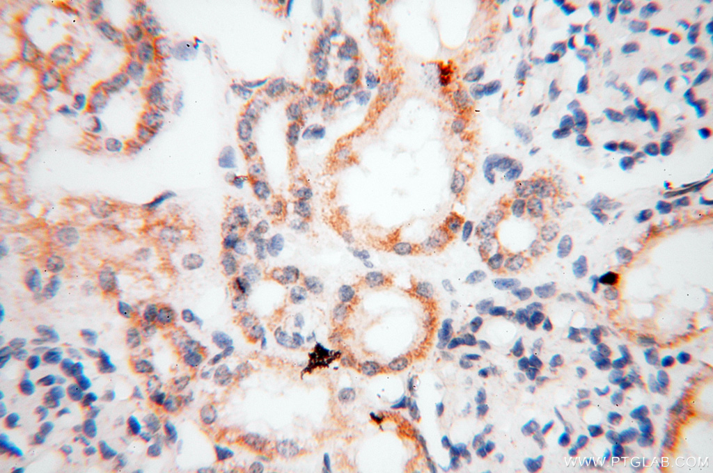 EB1 Polyclonal antibody