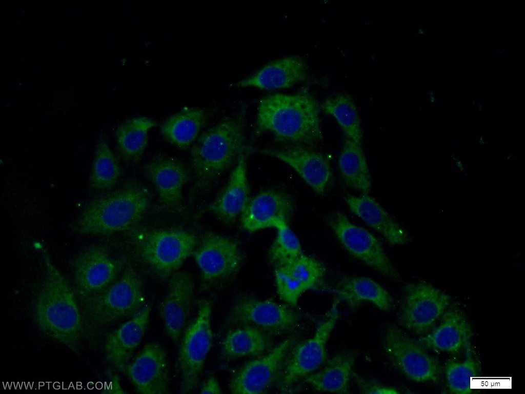 CSK Polyclonal antibody