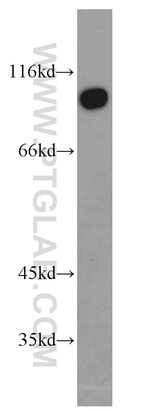 TJAP1 Polyclonal antibody