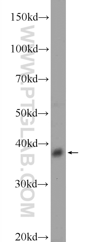DSN1 Polyclonal antibody