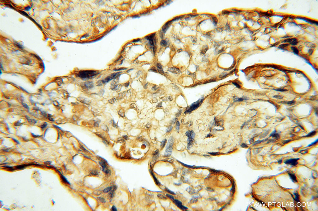 CHST14 Polyclonal antibody