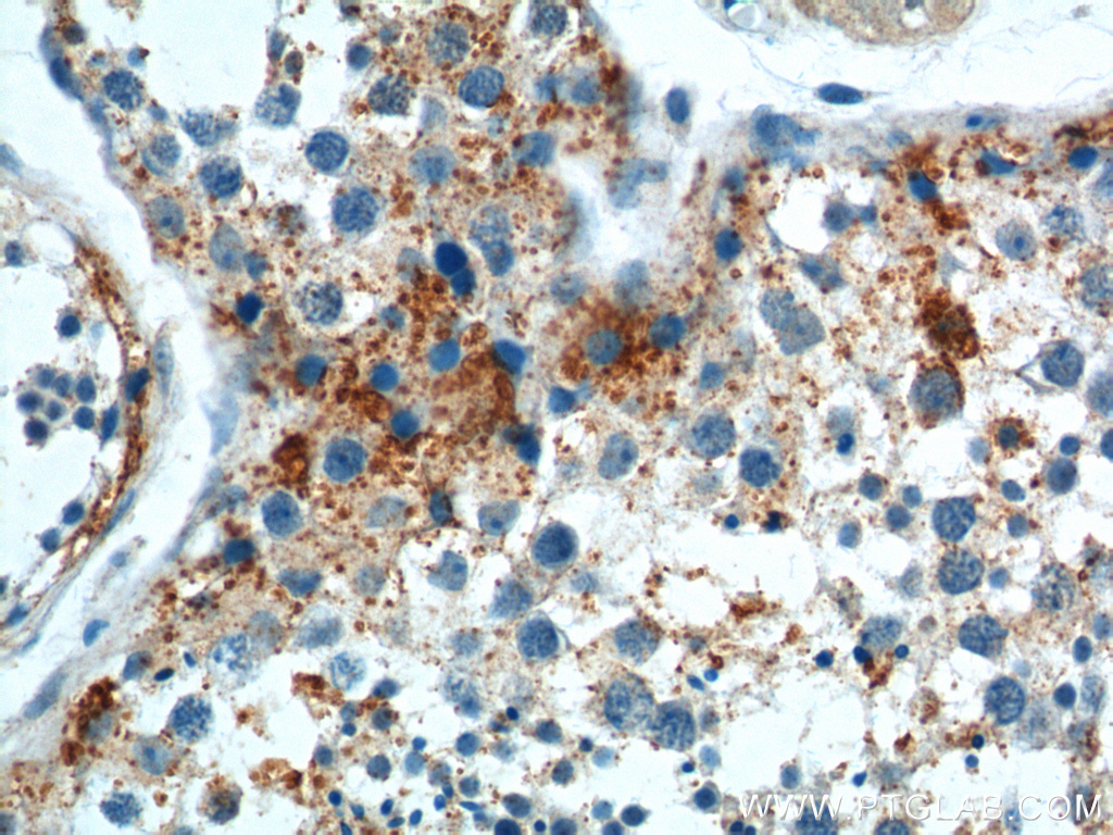 SOHLH1 Polyclonal antibody