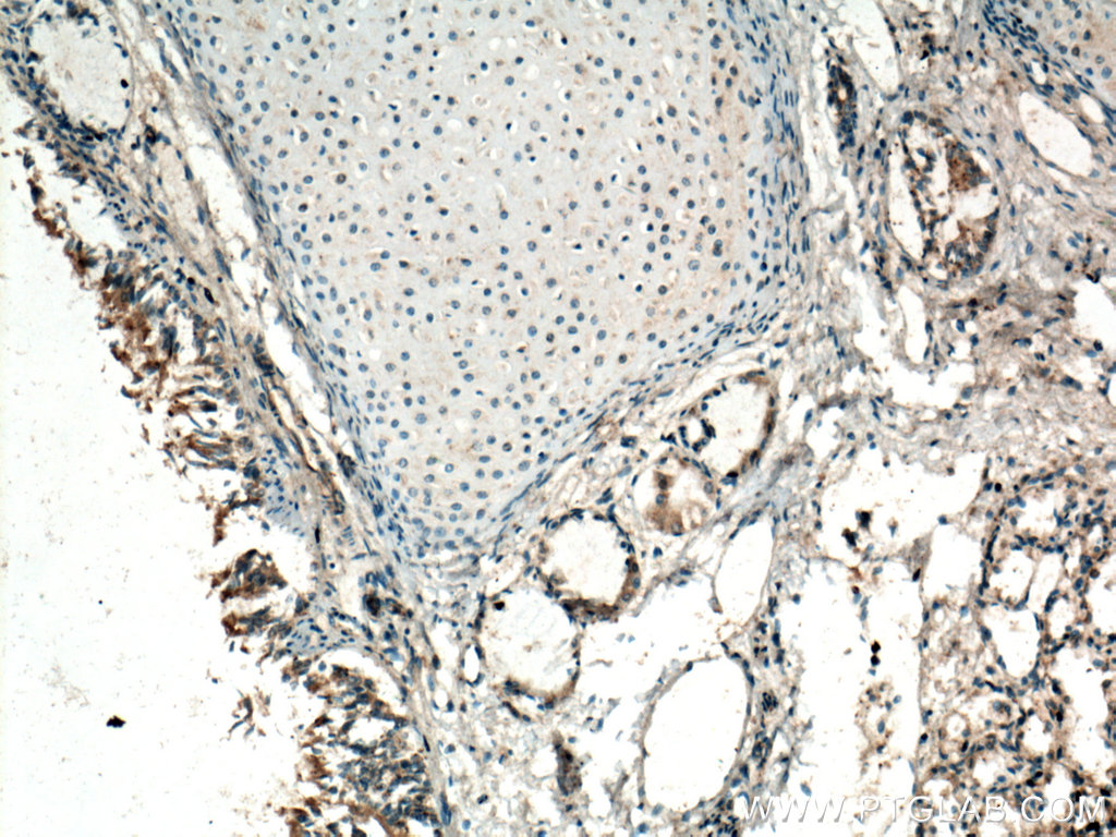 GM-CSF Polyclonal antibody