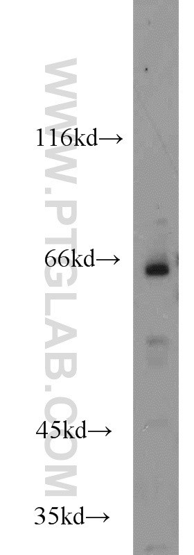 HSF5 Polyclonal antibody