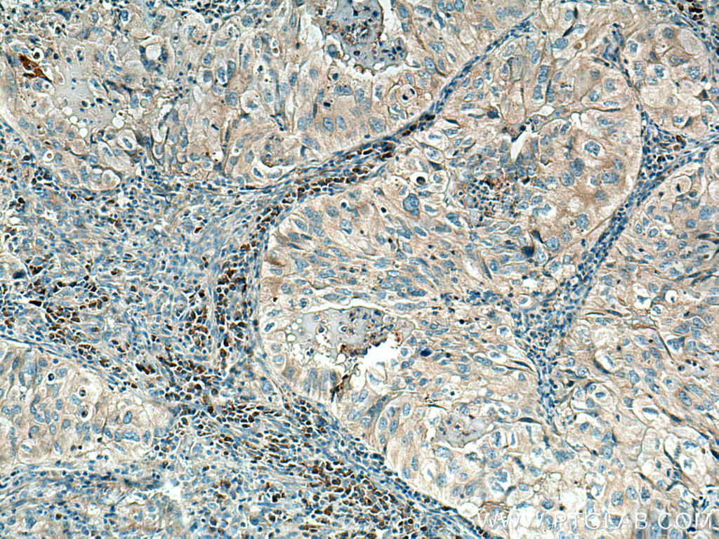 MYO1E Polyclonal antibody