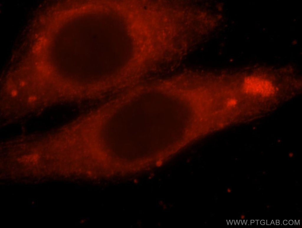 PDE7B Polyclonal antibody