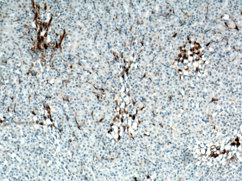 GPR126 Polyclonal antibody