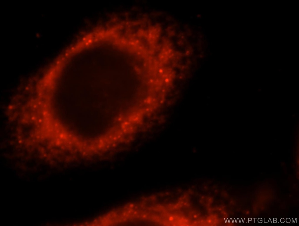 KLHL32 Polyclonal antibody