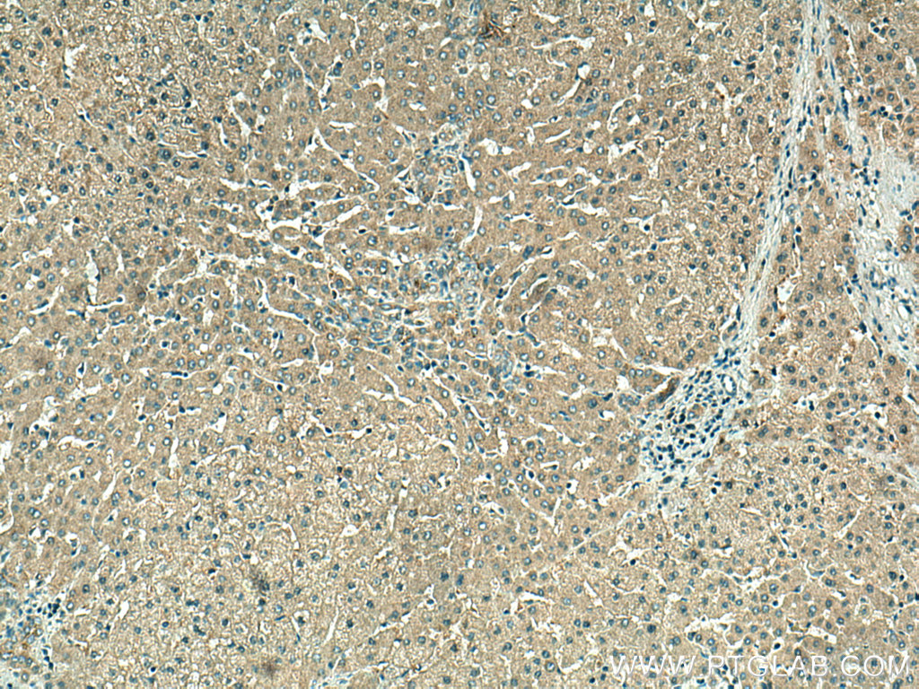 VPS16 Polyclonal antibody