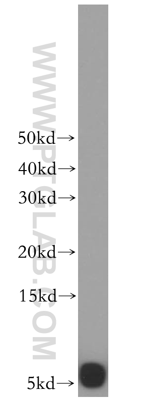 UCRC Polyclonal antibody