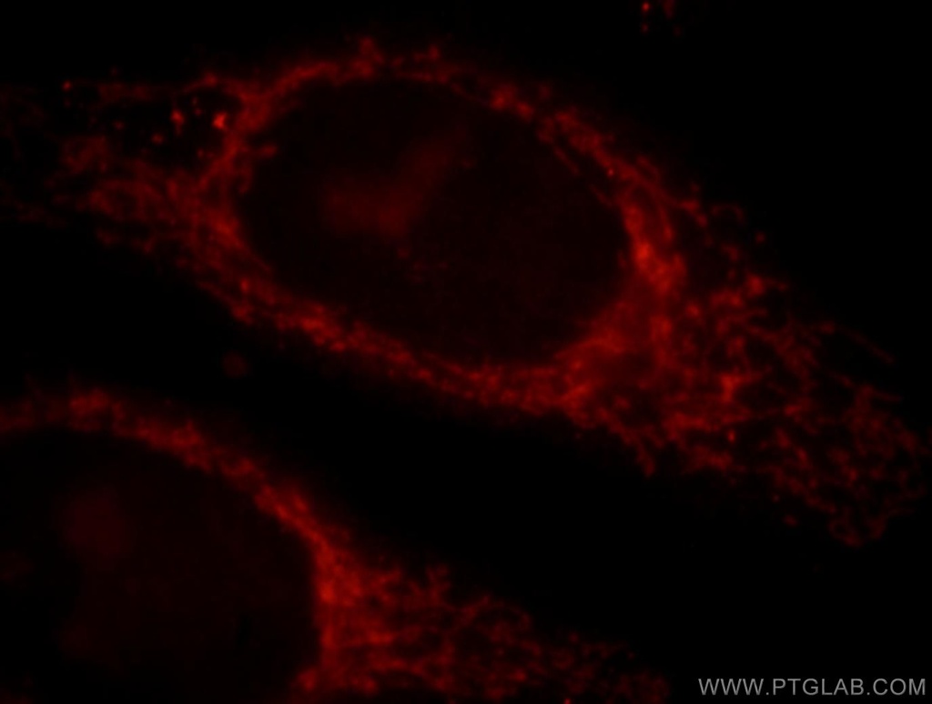 MAPKBP1 Polyclonal antibody