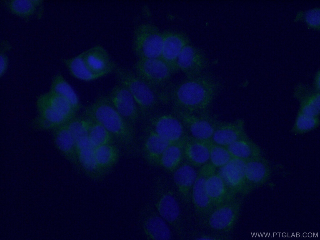 RIC8B Polyclonal antibody