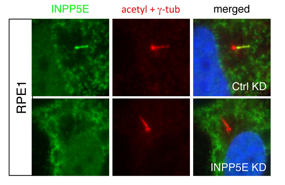 INPP5E Polyclonal antibody