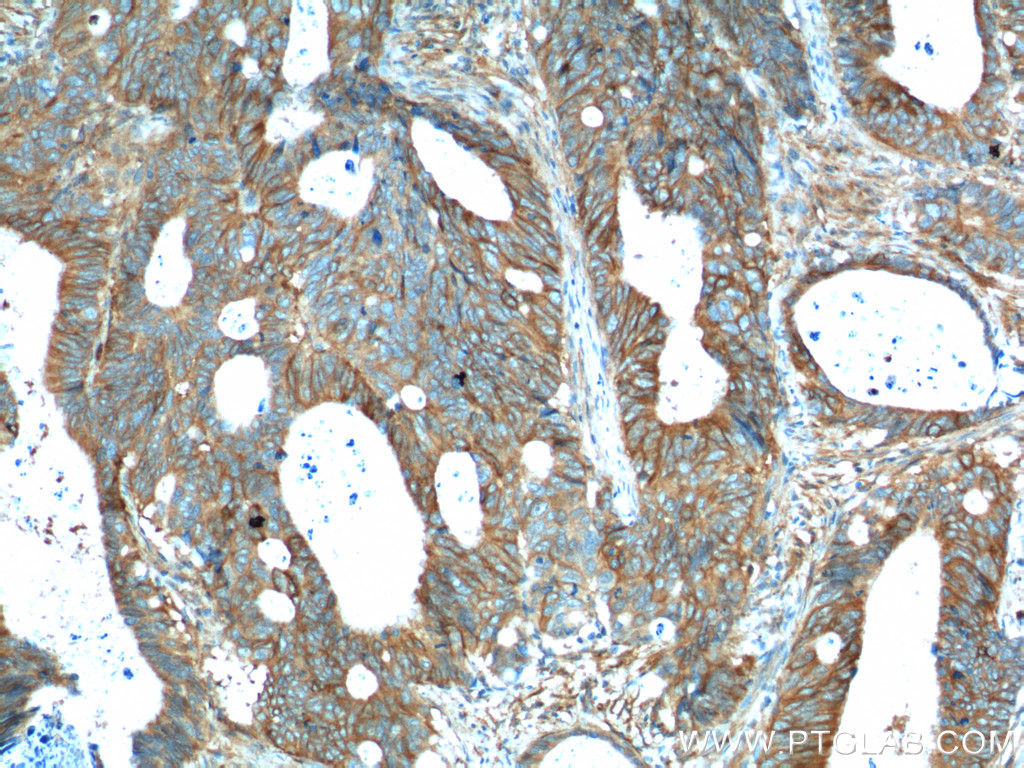 PTK7 Polyclonal antibody