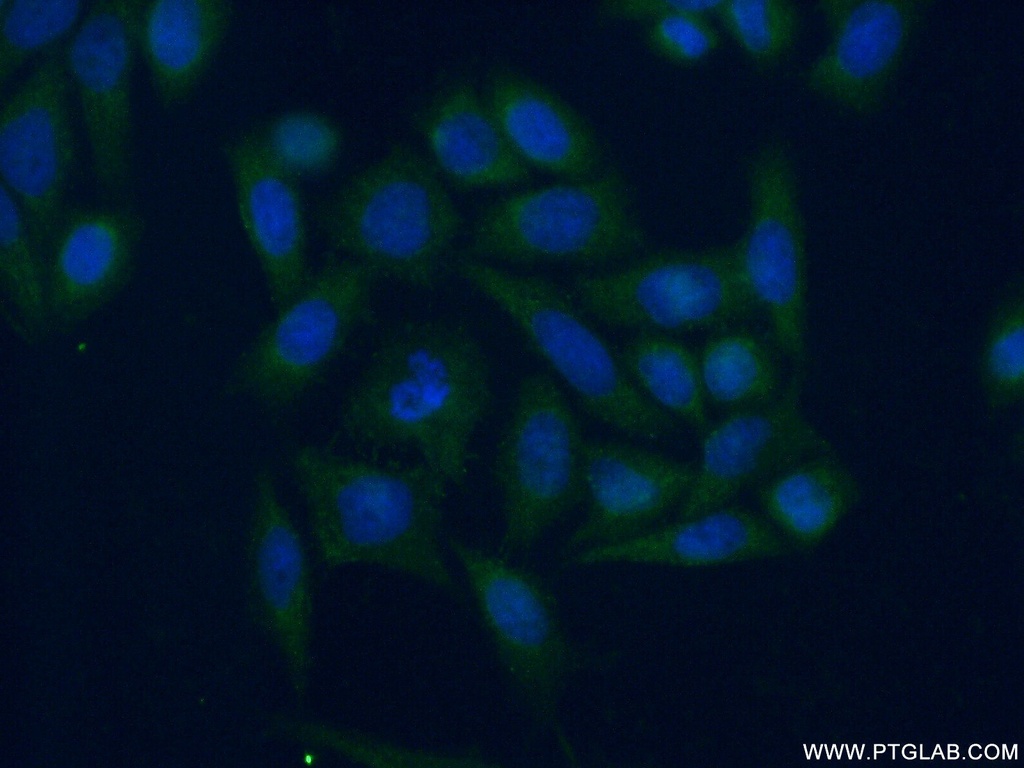SERP1 Polyclonal antibody