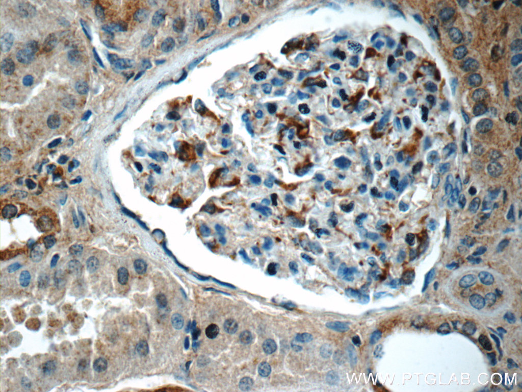 SNCAIP Polyclonal antibody