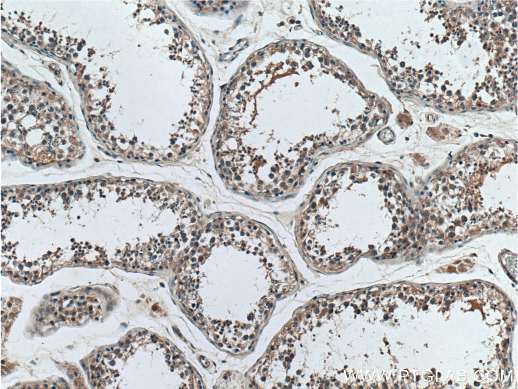 SAPS1 Polyclonal antibody