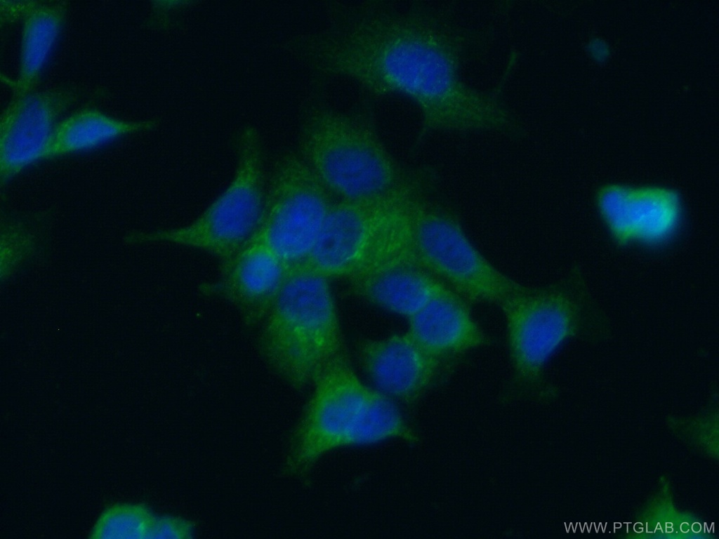 UCHL5IP Polyclonal antibody