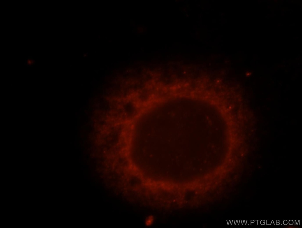 TNPO2 Polyclonal antibody
