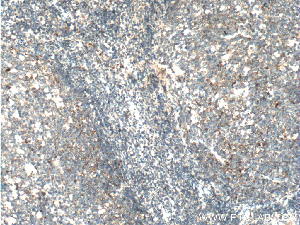 IL-3 Polyclonal antibody