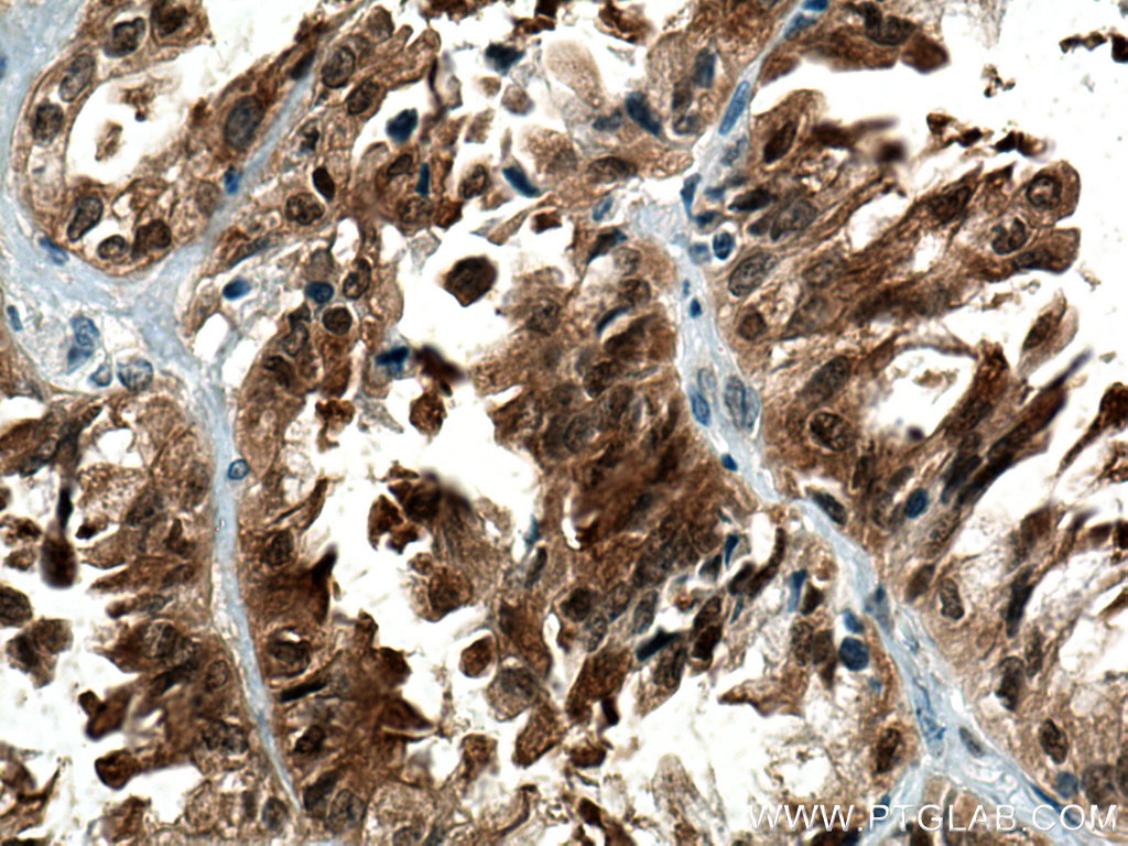 AHR Polyclonal antibody