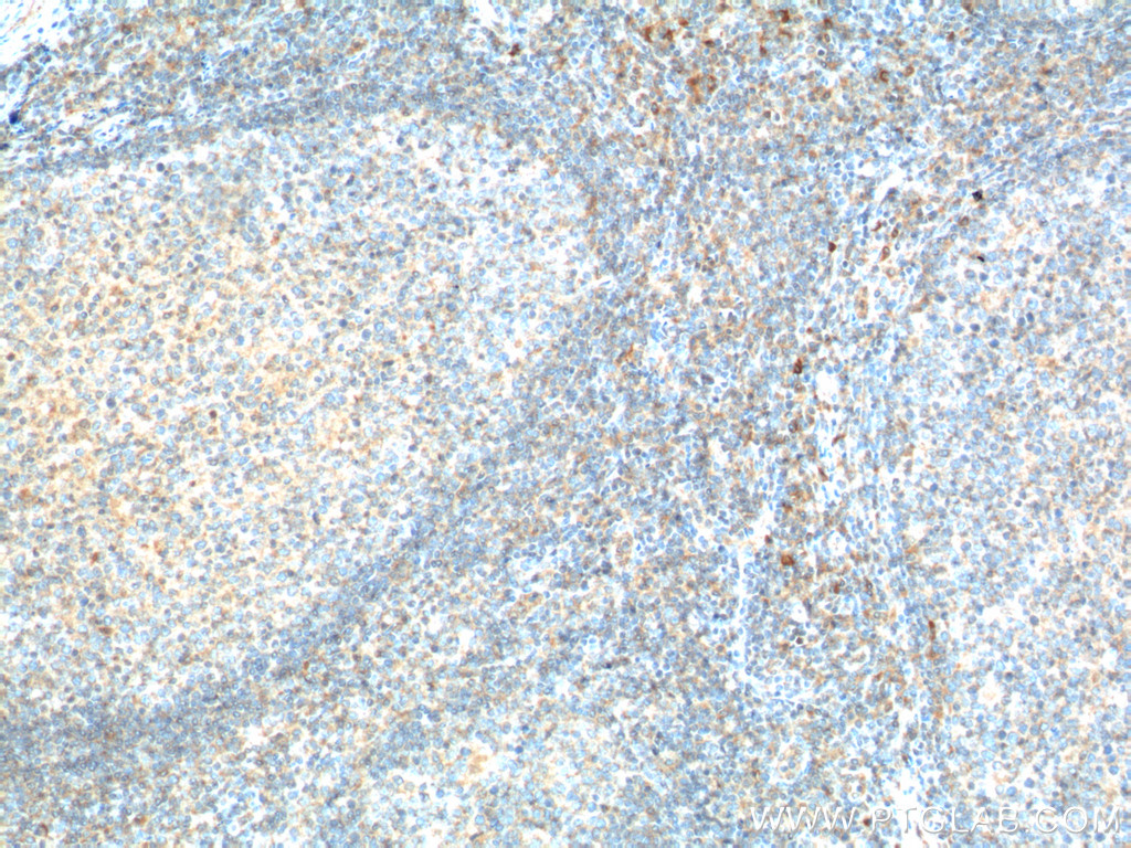 CD226 Polyclonal antibody