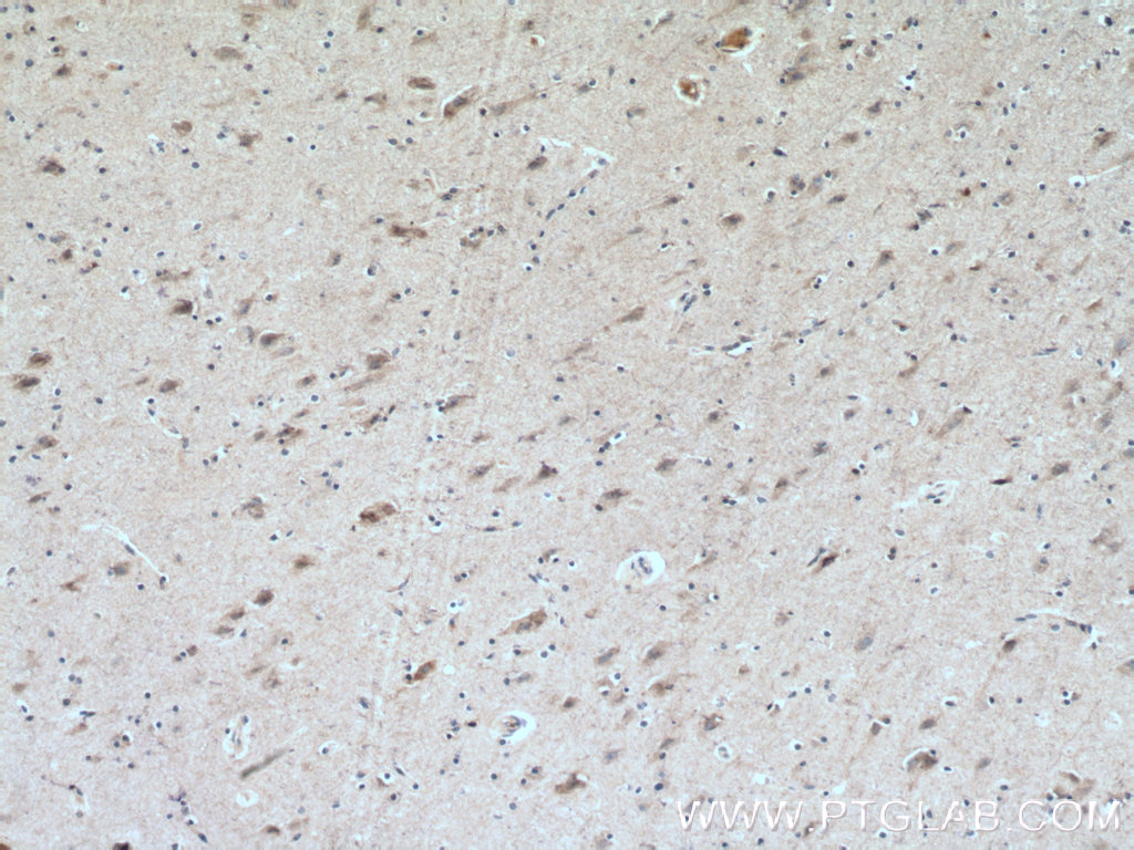 CHRNB2 Polyclonal antibody
