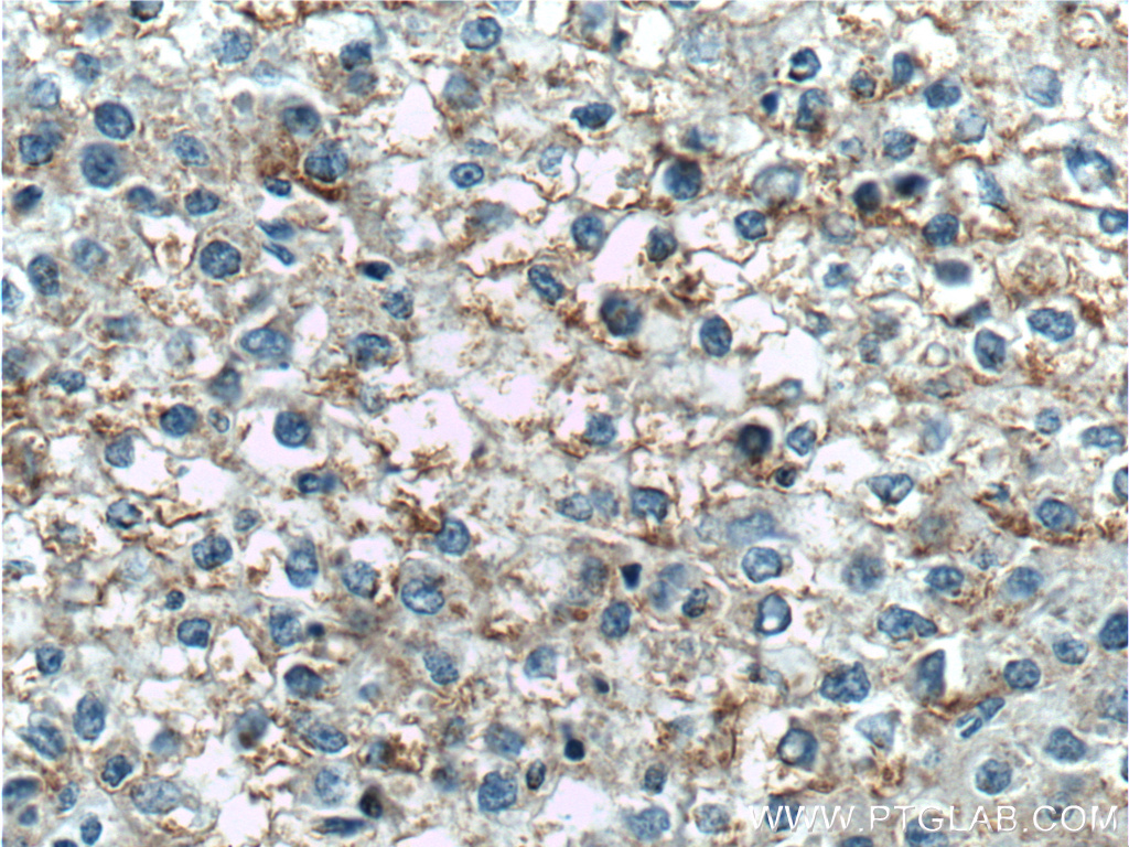 TNFSF8 Polyclonal antibody