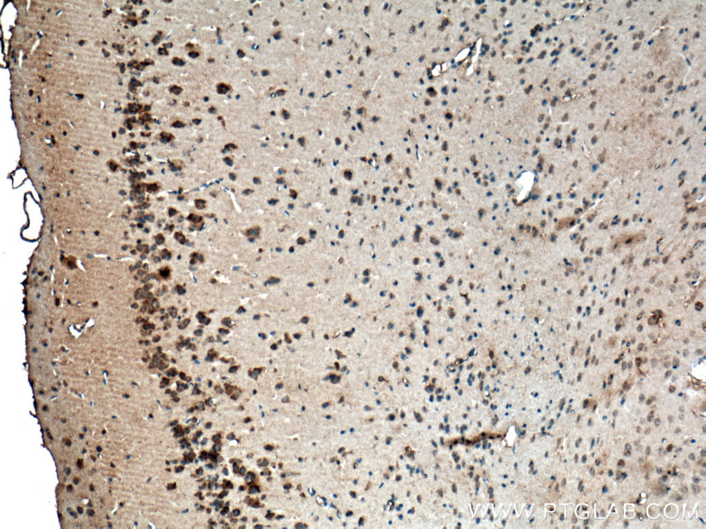 CACNG7 Polyclonal antibody
