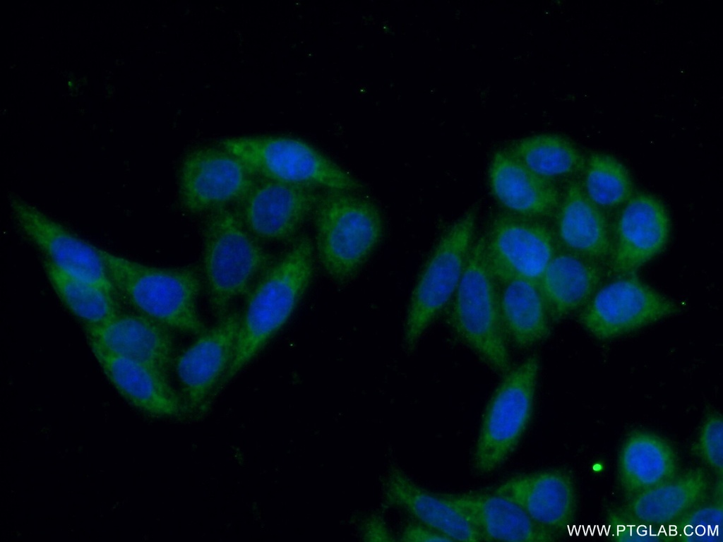 STS Polyclonal antibody