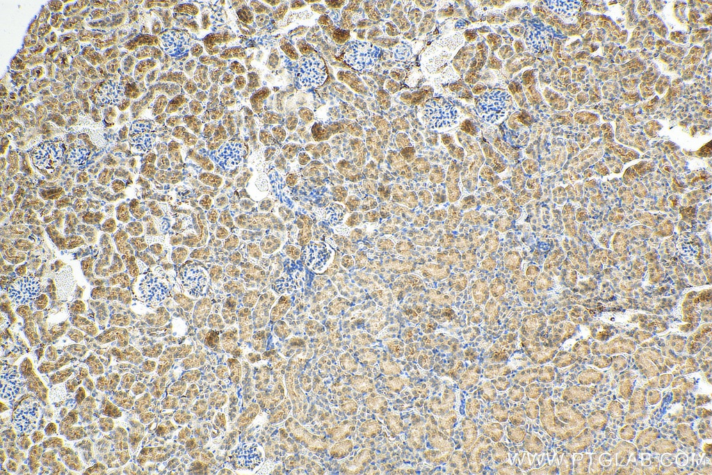 RANBP3L Polyclonal antibody