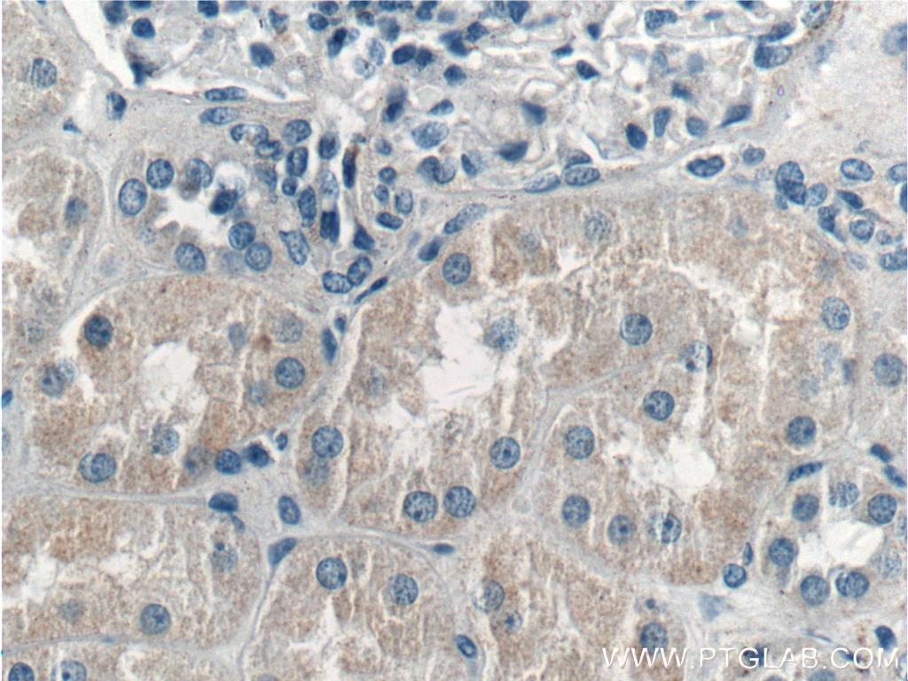 LMAN2L Polyclonal antibody