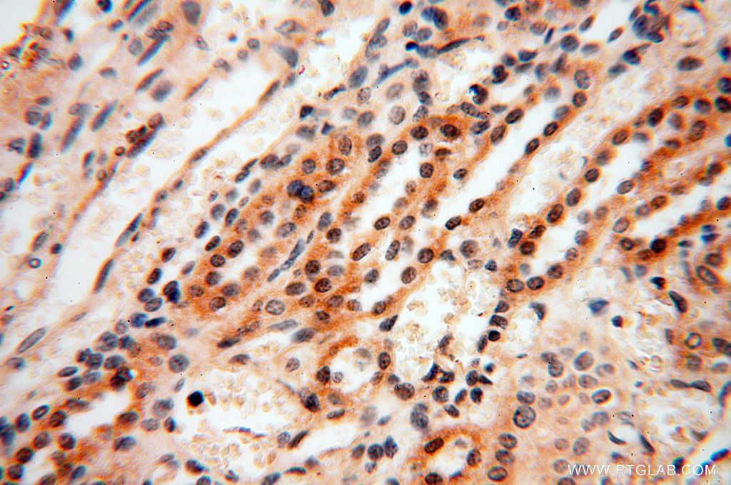 CAMSAP2 Polyclonal antibody