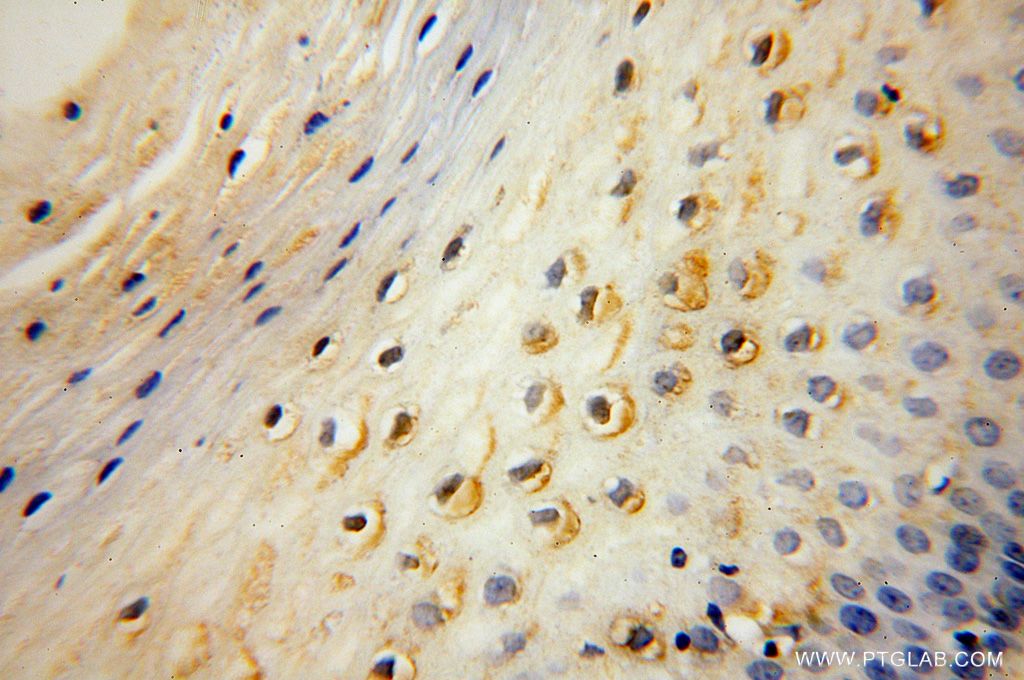 DGKQ Polyclonal antibody