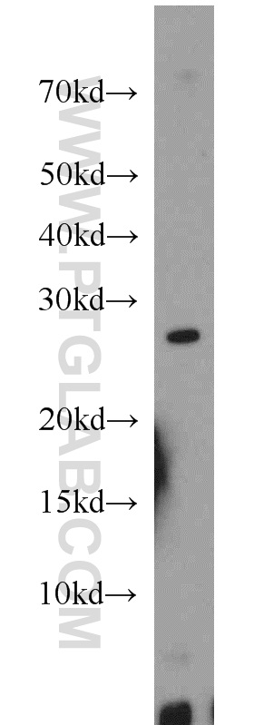MXD1 Polyclonal antibody