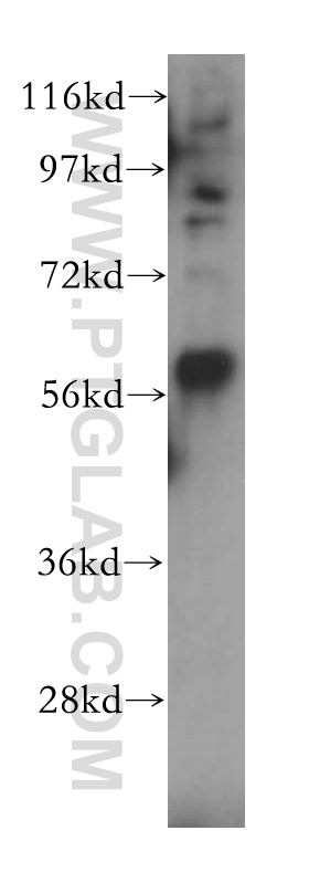 LPCAT4 Polyclonal antibody