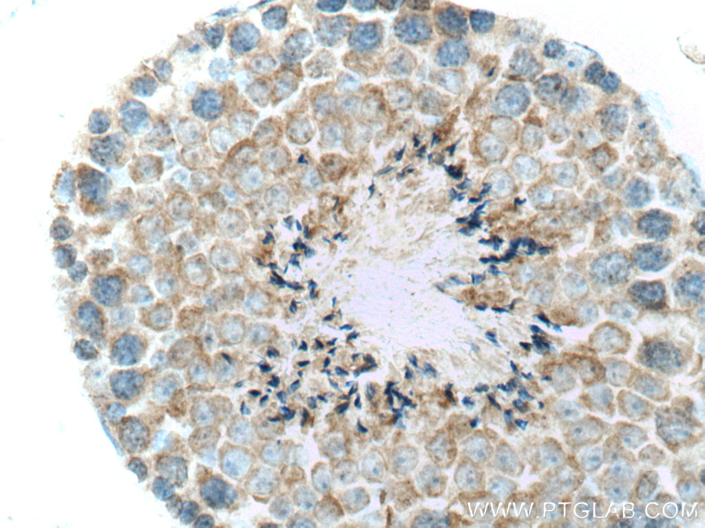 FAAH Polyclonal antibody