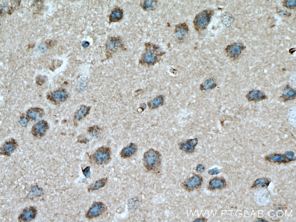 ADPRH Polyclonal antibody