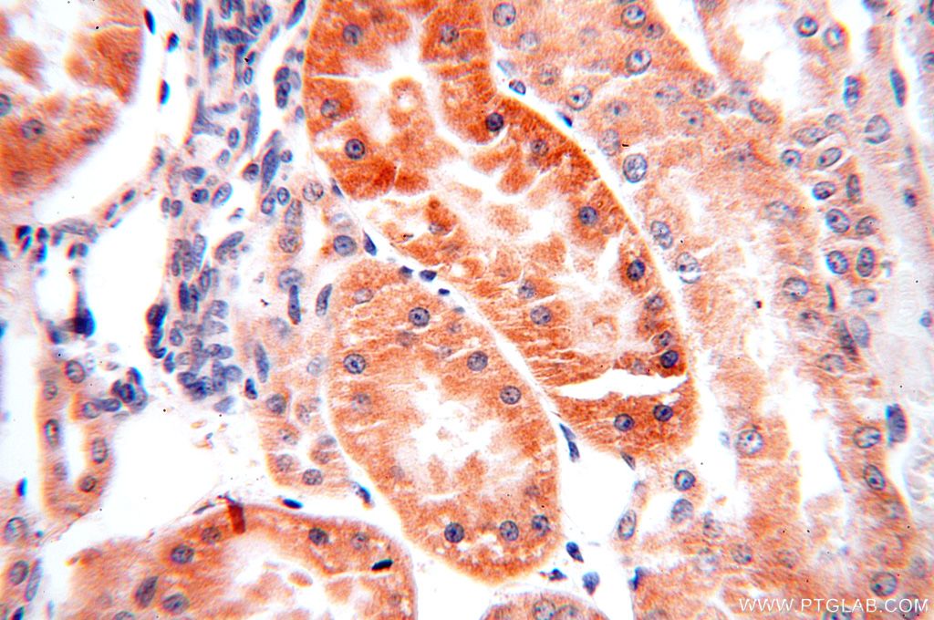 SNX5 Polyclonal antibody