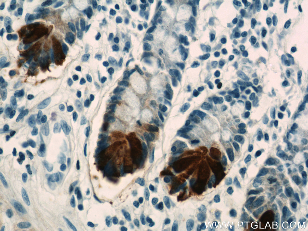 DEFA6 Polyclonal antibody