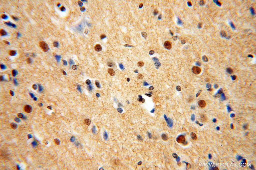 TUB Polyclonal antibody