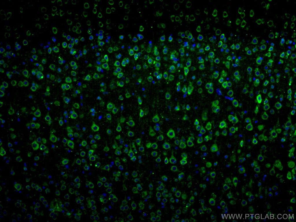 DRD1 Polyclonal antibody