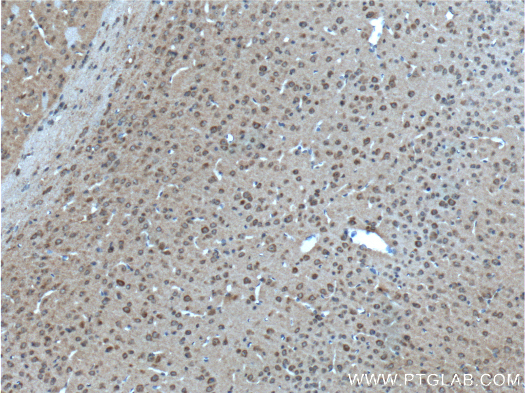 GPR75 Polyclonal antibody