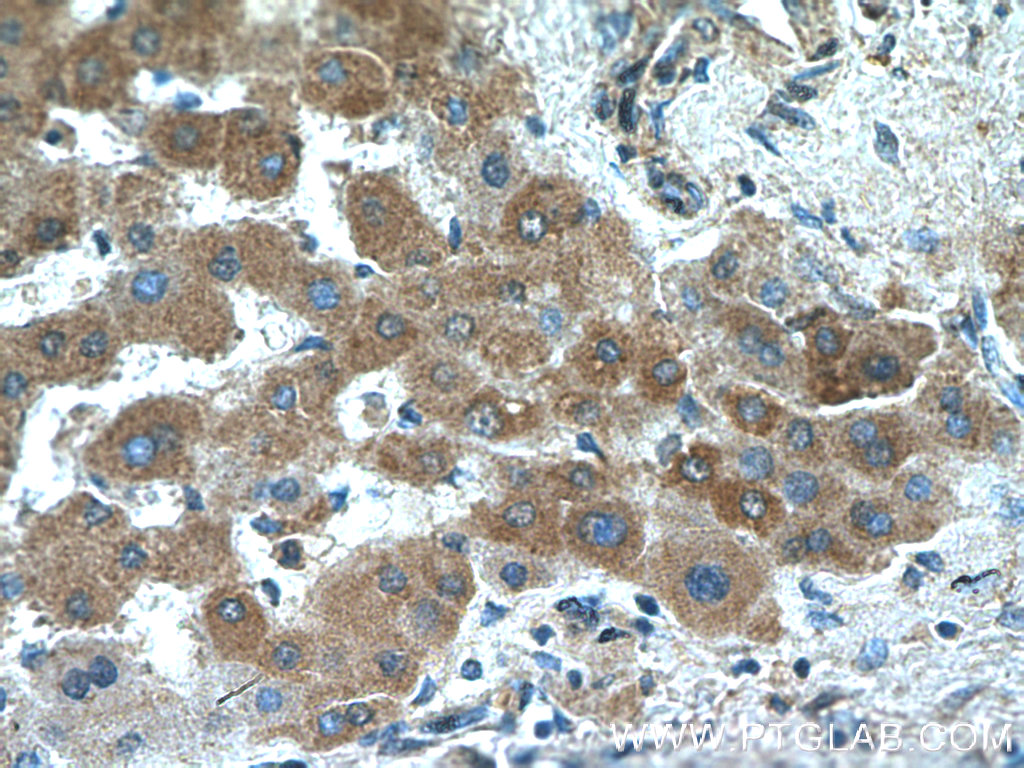 Acetylcholinesterase Polyclonal antibody