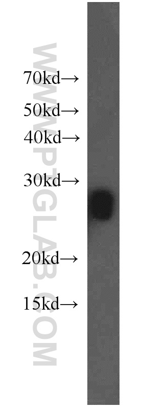 MIP Polyclonal antibody
